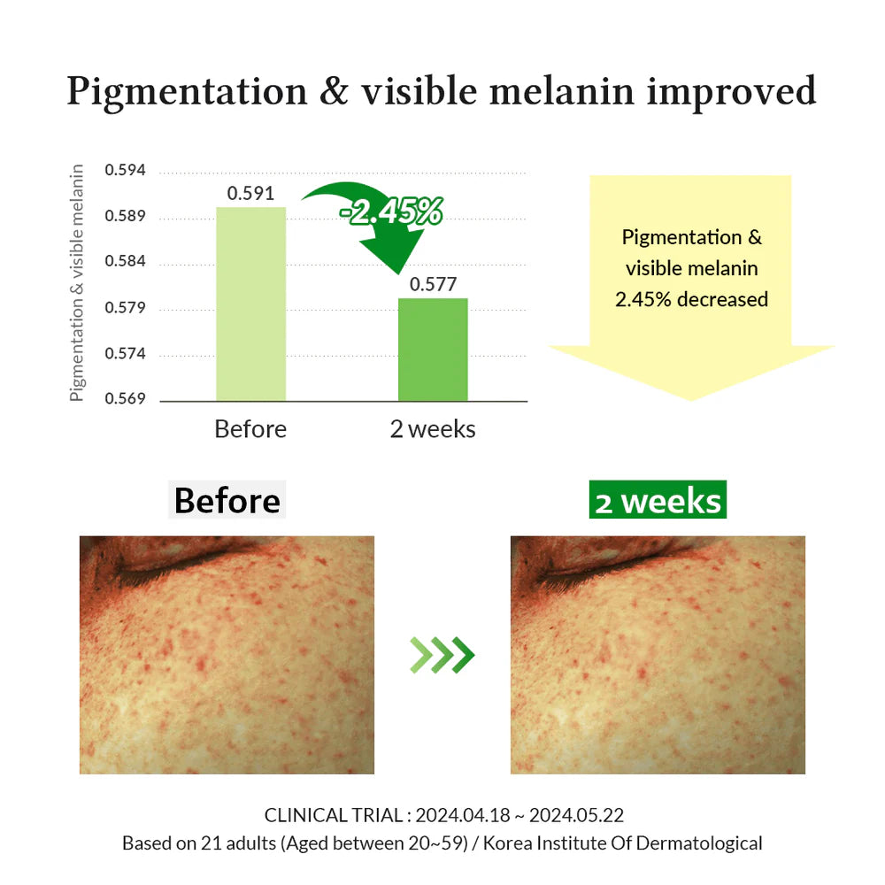 Dr. Althea Gentle Vitamin C Serum 30 ml - Sando Skin