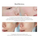 Dr. Althea Skin Relief Essence 30ml - Sando Skin