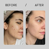 COSRX The Niacinamide 15 Serum 20 ml - Sando Skin