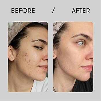 COSRX The Niacinamide 15 Serum 20 ml - Sando Skin