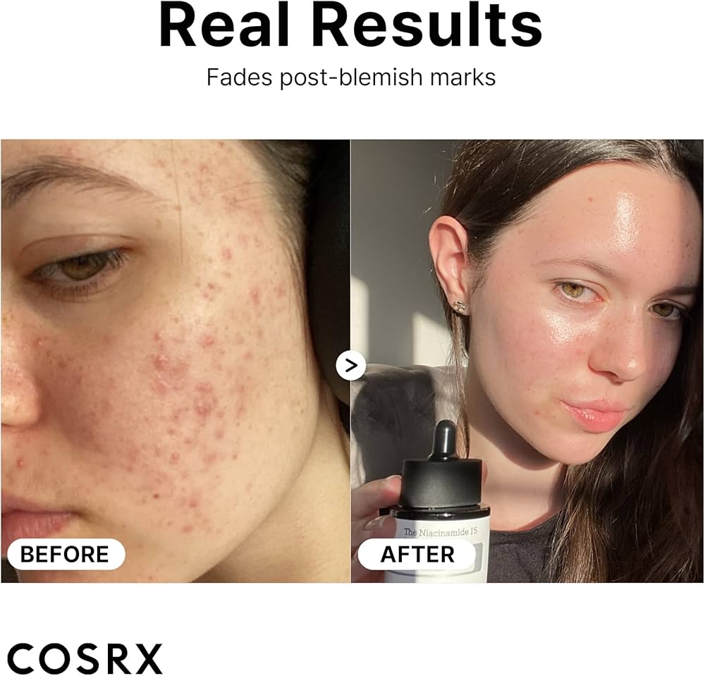 COSRX The Niacinamide 15 Serum 20 ml - Sando Skin