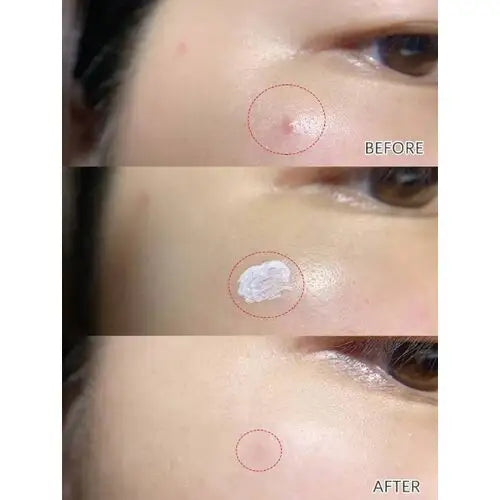 Dr. Jart+ Ctrl-A Teatreement Soothing Spot 15 ml - Sando Skin