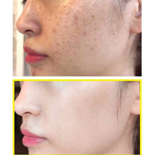 SOME BY MI Yuja Niacin 30 Days Blemish Care Serum 25g - Sando Skin