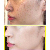 SOME BY MI Yuja Niacin 30 Days Blemish Care Serum 25g - Sando Skin