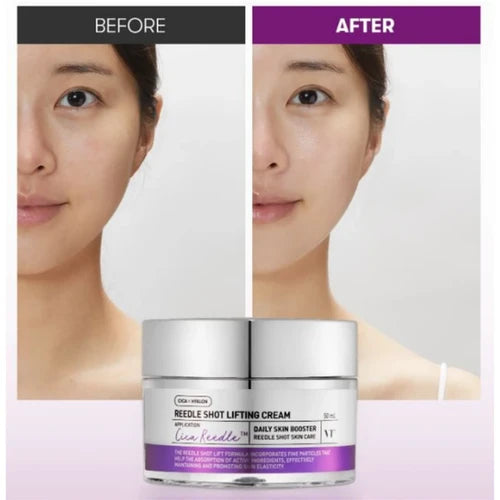 VT Cosmetics Reedle Shot Lifting Cream 50ml - Sando Skin