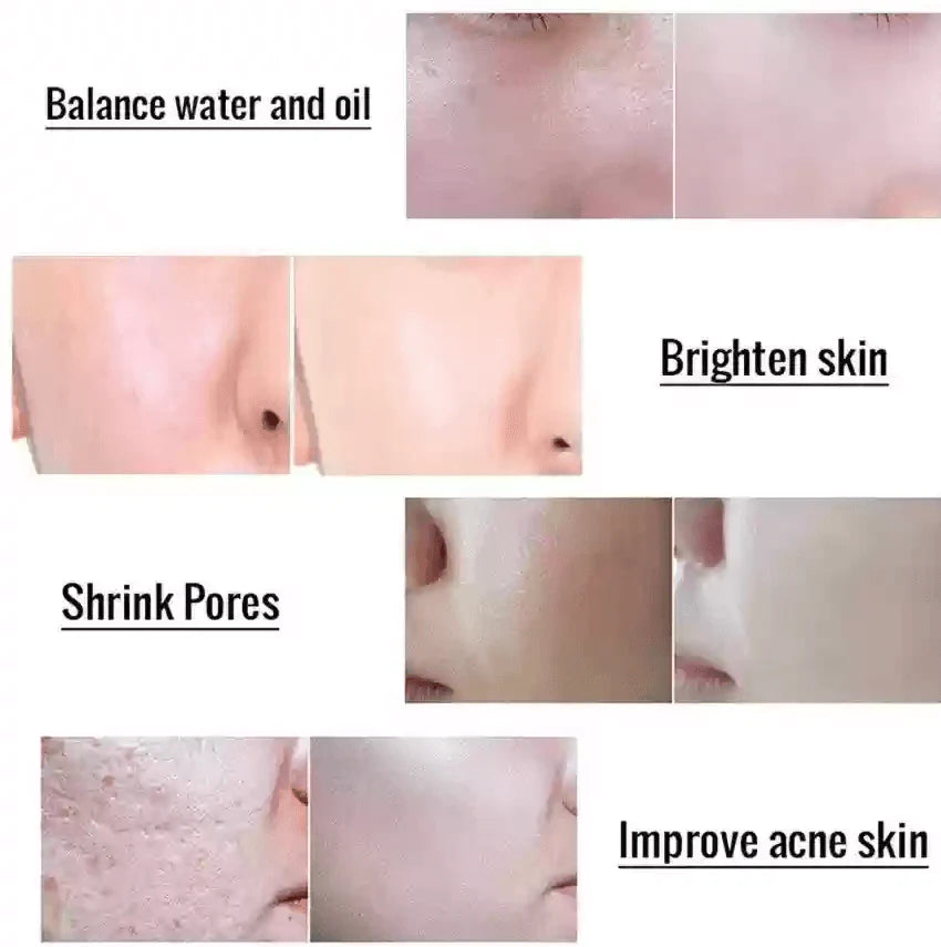 TIRTIR SOS Serum 50ml - Sando Skin