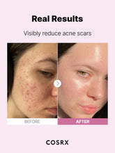 COSRX The Niacinamide 15 Serum 20 ml - Sando Skin