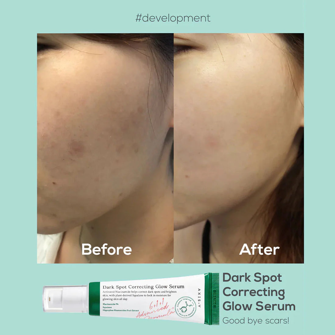 Axis-Y Dark Spot Correcting Glow Serum Corrects & Brightens 50 ml - Sando Skin